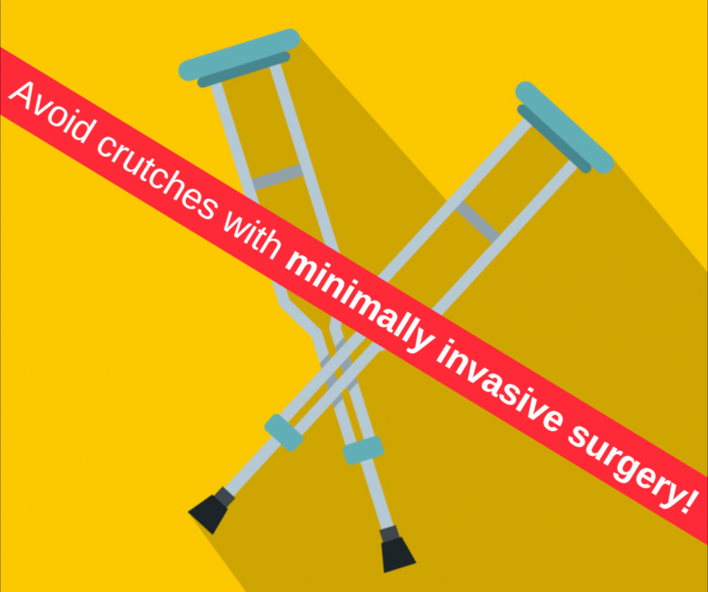 Why You Won’t Need Crutches After Foot Surgery Nagy Footcare