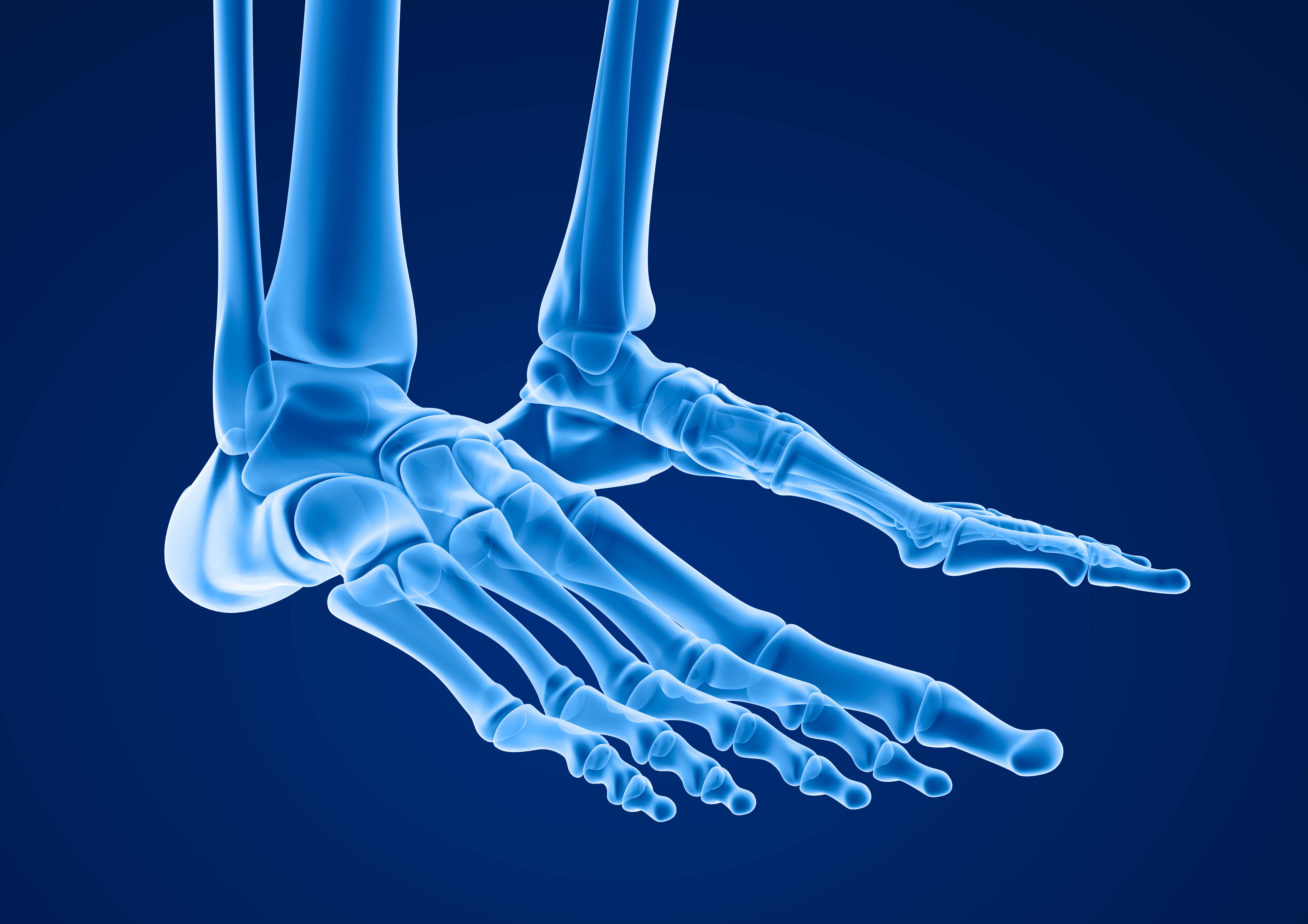 x-ray image of foot 